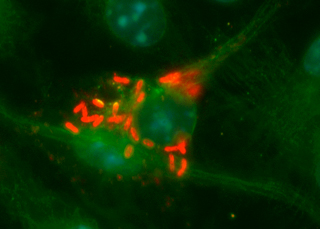 Legionella pneumophila bacteria. Photo Courtesy of Brenda Byrne / University of Michigan
